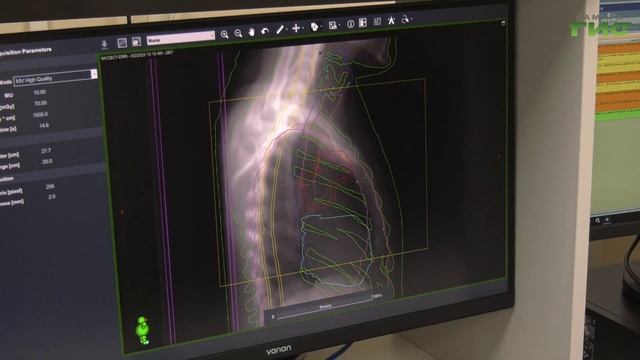 В самарском онкологическом диспансере появился линейный ускоритель для проведения лучевой терапии смотреть онлайн