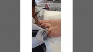 Правила обработки стержневой мозоли