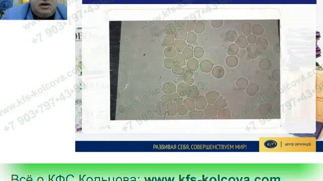 Аксельрод А.Е. 2017-11-13 «Что такое КФС Как правильно применять» #кфскольцова