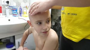 Теперь я лысое чудовище: ::( Родители издеваются