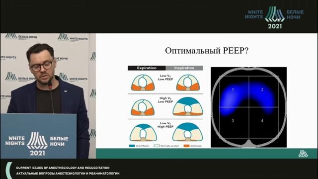 Искуственная вентиляция легких у пациентов с морбидным ожирением