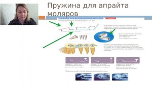 21. Дополнительные элементы в работе врача ортодонта (720p) (1)