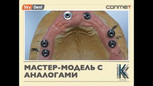 Разъемные абатменты Конмет