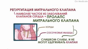 Шумы сердца: примеры (слушать в наушниках), причины и механизм, виды