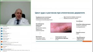 Аллергические дерматозы  Алгоритм диагностики и терапии