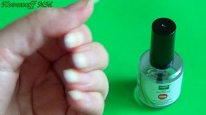 Лечим грибок ногтей БЮДЖЕТНЫМ лаком СТОП-ГРИБОК.