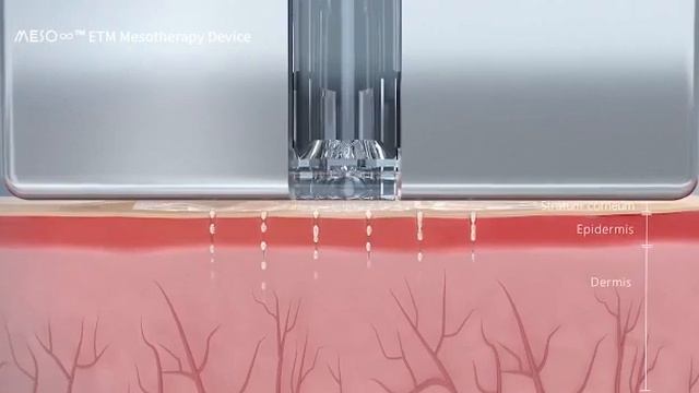 Meso Infinity Needle-free Mesotherapy Device
