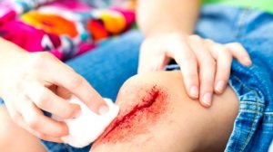 Чтобы прожить до 100 лет отожми сок Чистотела, Лечит практически Всё! Чистотел внутрь и кому нельзя