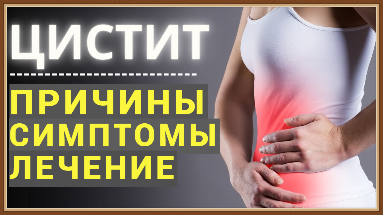 ЦИСТИТ - ПРИЧИНЫ СИМПТОМЫ ЛЕЧЕНИЕ