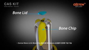 CAS KIT.  Ознакомление с набором