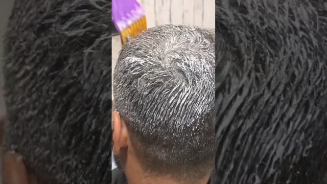 Dandruff removal