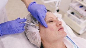 КОНТУРНАЯ ПЛАСТИКА ЛИЦА RADIESSE Сеть клиник косметологии Gen87