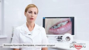 Ортодонтия_ брекеты, элайнеры. Москва.