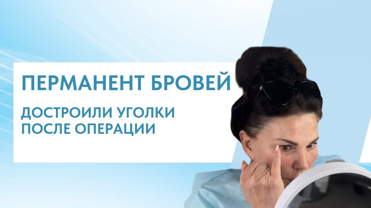 ПЕРМАНЕНТ БРОВЕЙ | ДОСТРОИЛИ КОНЧИКИ БРОВЕЙ ПОСЛЕ ОПЕРАЦИИ