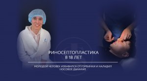 Риносептопластика для молодого парня