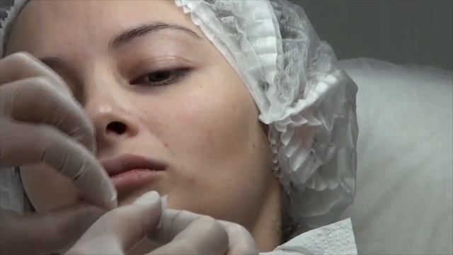 V-Skin - защитный пластырь