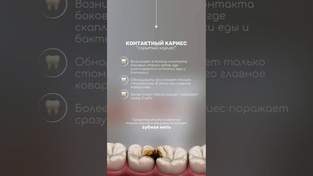 Зубная нить: польза или вред?