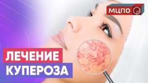 Лечение КУПЕРОЗА на лице. Курс косметологов в МЦПО