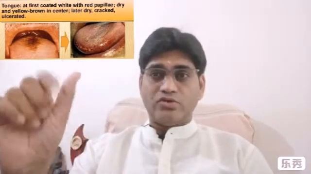 Baptisia Tinctoria fully explained смотреть онлайн