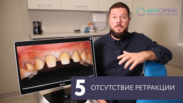 Ошибки интраорального сканирования на примере Primescan