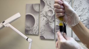 Плазмалифтинг Prp Кортексил