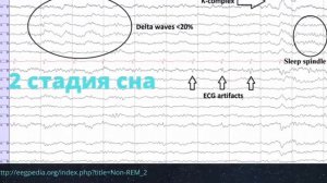 Лекция ЭЭГ во время сна. Часть I.