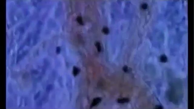 Как на самом деле бороться со свободными радикалами