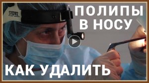 КАК УДАЛИТЬ ПОЛИПЫ В НОСУ.mp4
