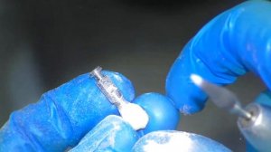 Временные коронки на имплантах dentium