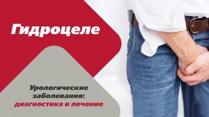 Урологические заболевания: диагностика и лечение. Гидроцеле