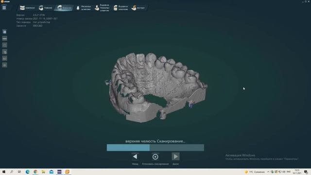Сканирование гипсовой модели смотреть онлайн