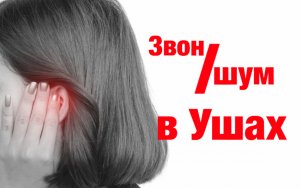 Шум в ушах - всё, что нужно знать.