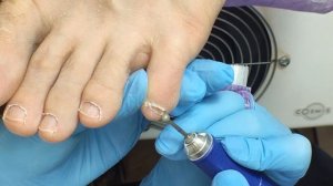 МУЖСКОЙ ПЕДИКЮР. ПОДРОБНАЯ ОБРАБОТКА ПАЛЬЧИКОВ. ГИГИЕНИЧЕСКИЙ ПЕДИКЮР. PEDICURE. MEN'S PEDICURE, 腳趾