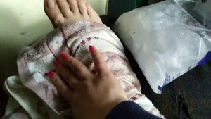 Подвернула ногу.Что делать в первые минуты?