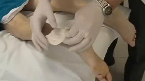 Сахарный диабет, и его последствия.