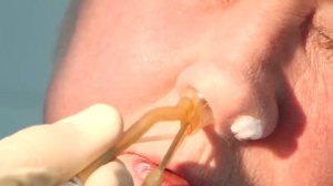 Запись к врачу через ЕМИАС Москва  Медицинский Центр "Столица"