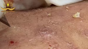 Most Satisfying and Relaxation with An Spa Video #133