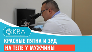 ? Красные пятна и зуд на теле у мужчины. Клинический случай №995