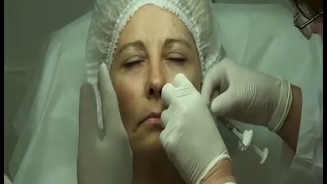 Контурная пластика, учимся держать канюлю в руках смотреть онлайн