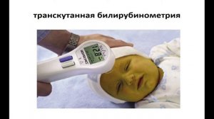 11:30-14:50 Гемолитическая болезнь новорожденного