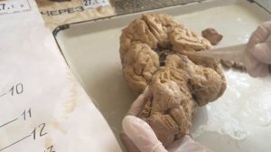 Головной мозг. Продолговатый мозг. Задний мозг.