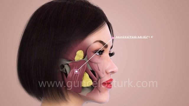 Бихэктомия (удаление жира из щёк) - Щёки Нефертити - Как это работает? Доктор Гунцель Озтурк смотреть онлайн