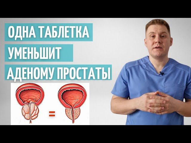 Какой врач лечит простату у мужчин. Доктор Евдокименко аденома предстательной.