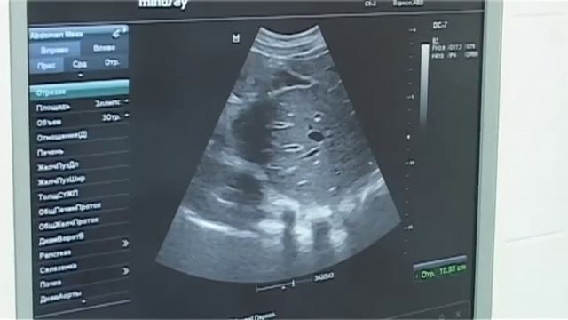 Центр акушерства и гинекологии на Комсомольском проспекте 103 ДНК Клиника Челябинск смотреть онлайн