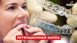 Ретенционная каппа