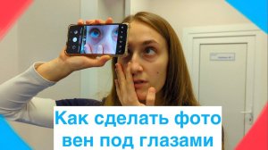 Как сделать фото вен под глазами? / Лазерное удаление вен под глазами