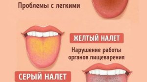 Що означає коричневый налёт, желтый налёт, серый налёт на языке.