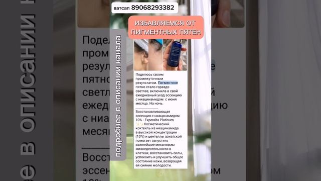 КАК ИЗБАВИТЬСЯ ОТ ПИГМЕНТНЫХ ПЯТЕН? #пигментныепятна #здоровье