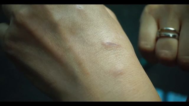 ПРОБИОТИКИ. Спрей "Спасатель". Средство для заживления раны смотреть онлайн