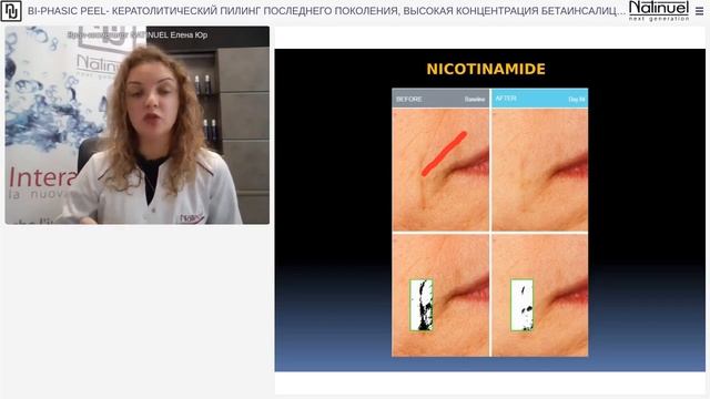 BI PHASIC PEEL КЕРАТОЛИТИЧЕСКИЙ ПИЛИНГ ПОСЛЕДНЕГО ПОКОЛЕНИЯ, ВЫСОКАЯ КОНЦЕНТРАЦИЯ БЕТАИНСАЛИЦИЛАТА смотреть онлайн